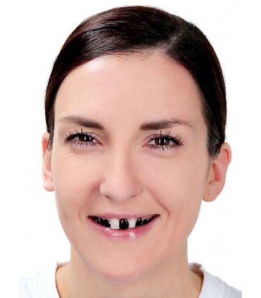 LACA PARA DIENTES NEGRO