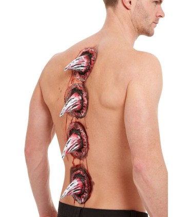 HERIDAS DE LATEX