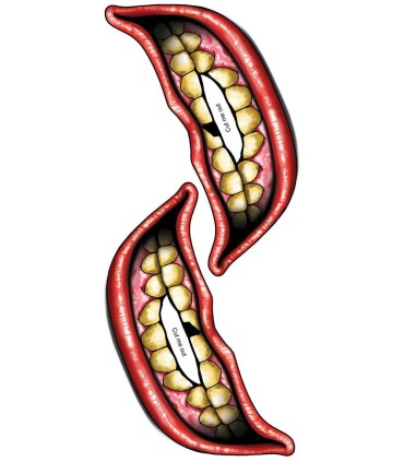 BIG MOUTH CHIPPED